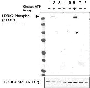 Western blot - Anti-LRRK2 (phospho T1491) antibody [MJFR5-88-3] - BSA and Azide free (AB206034)