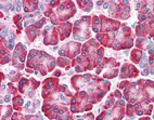 Immunohistochemistry (Formalin/PFA-fixed paraffin-embedded sections) - Anti-LRRN4 antibody (AB133372)