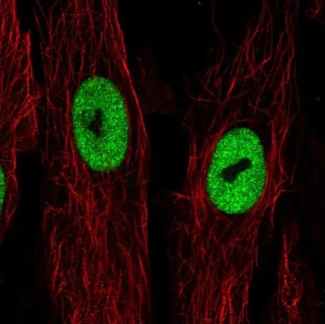 Immunocytochemistry/ Immunofluorescence - Anti-LRRN4CL antibody (AB188018)