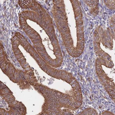 Immunohistochemistry (Formalin/PFA-fixed paraffin-embedded sections) - Anti-LRRN4CL antibody (AB188018)