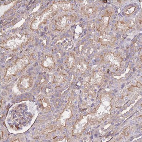 Immunohistochemistry (Formalin/PFA-fixed paraffin-embedded sections) - Anti-LRRN4CL antibody (AB188018)