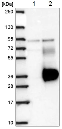 Western blot - Anti-LRRN4CL antibody (AB188018)