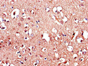 Immunohistochemistry (Formalin/PFA-fixed paraffin-embedded sections) - Anti-LRRTM4 antibody (AB234876)