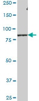 Western blot - Anti-LRSAM1 antibody (AB73113)