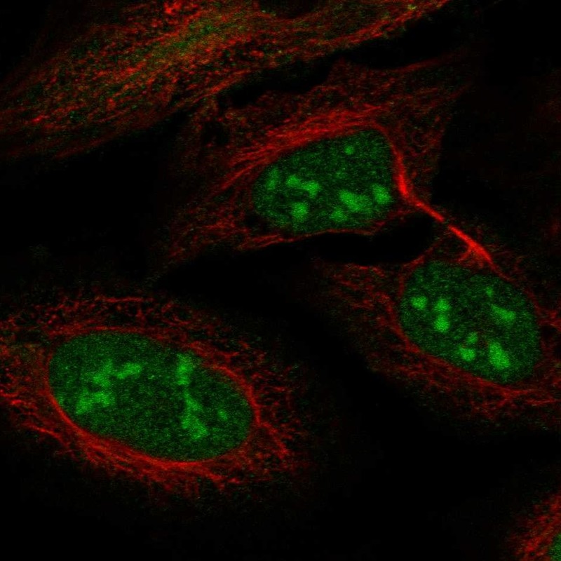 Immunocytochemistry/ Immunofluorescence - Anti-LRWD1 antibody (AB251732), expandable thumbnail