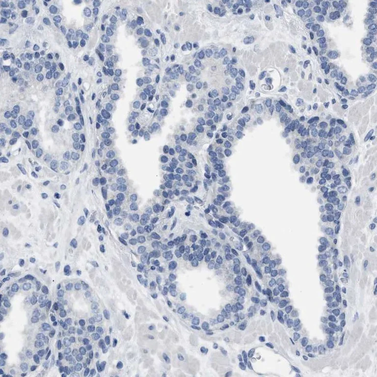 Immunohistochemistry (Formalin/PFA-fixed paraffin-embedded sections) - Anti-LRWD1 antibody (AB251732)