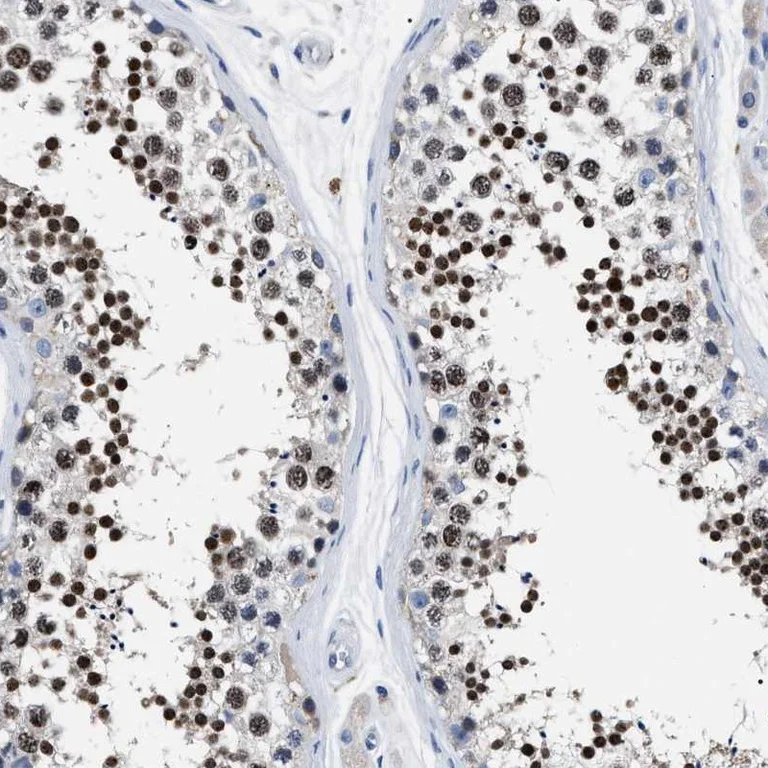 Immunohistochemistry (Formalin/PFA-fixed paraffin-embedded sections) - Anti-LRWD1 antibody (AB251732)