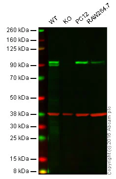 Western blot - Anti-LSD2 / AOF1 antibody [EPR18508] (AB193080)