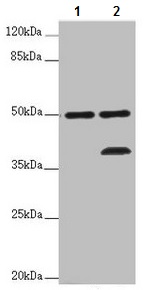 Western blot - Anti-LSDP5 antibody (AB222811), expandable thumbnail