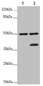Western blot - Anti-LSDP5 antibody (AB222811)