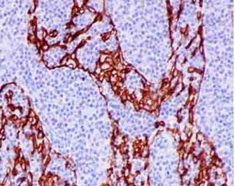 Immunohistochemistry (Formalin/PFA-fixed paraffin-embedded sections) - Anti-LSECtin antibody [EPR13724] (AB181196), expandable thumbnail