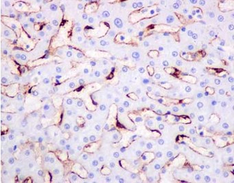 Immunohistochemistry (Formalin/PFA-fixed paraffin-embedded sections) - Anti-LSECtin antibody [EPR13724] (AB181196), expandable thumbnail