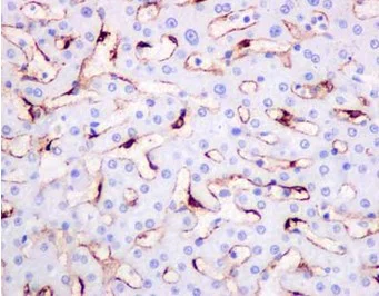 Immunohistochemistry (Formalin/PFA-fixed paraffin-embedded sections) - Anti-LSECtin antibody [EPR13724] (AB181196)