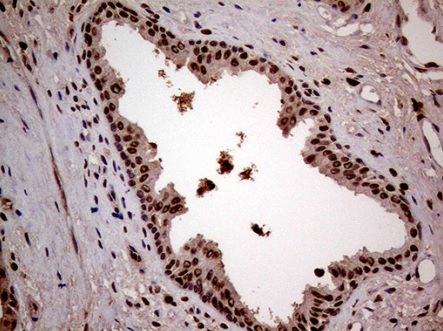 Immunohistochemistry (Formalin/PFA-fixed paraffin-embedded sections) - Anti-LSM11 antibody [OTI2G7] (AB236396)