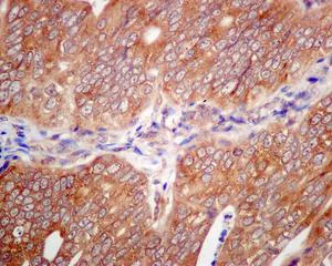 Immunohistochemistry (Formalin/PFA-fixed paraffin-embedded sections) - Anti-LSM12 antibody [EPR12282-87] (AB173292)