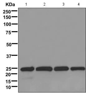 Western blot - Anti-LSM12 antibody [EPR12282-87] (AB173292)