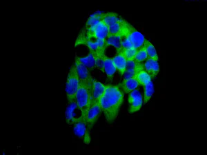 Immunocytochemistry/ Immunofluorescence - Anti-LSM12 antibody [EPR12282-87] - BSA and Azide free (AB249753)