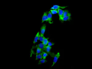 Immunocytochemistry/ Immunofluorescence - Anti-LSM12 antibody [EPR12282] (AB173291)