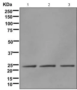 Western blot - Anti-LSM12 antibody [EPR12282] (AB173291)