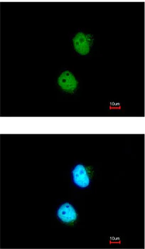 Immunocytochemistry/ Immunofluorescence - Anti-LSM4 antibody (AB153959)