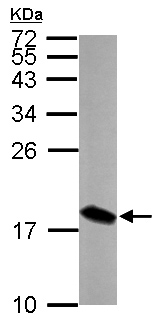 Western blot - Anti-LSM4 antibody (AB153959), expandable thumbnail