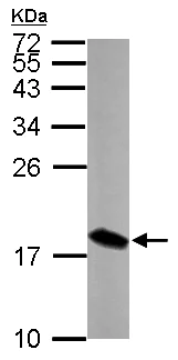 Western blot - Anti-LSM4 antibody (AB153959)