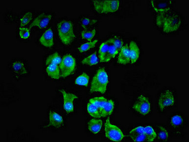 Immunocytochemistry/ Immunofluorescence - Anti-LSM4 antibody (AB236744)