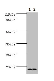 Western blot - Anti-LSM4 antibody (AB236744)