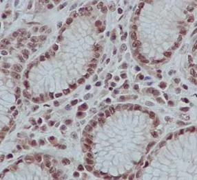 Immunohistochemistry (Formalin/PFA-fixed paraffin-embedded sections) - Anti-LSM5 antibody [EPR10690] (AB184568)