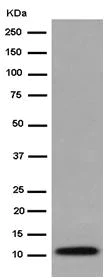 Western blot - Anti-LSM5 antibody [EPR10690] (AB184568)