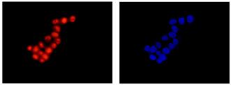 Immunocytochemistry/ Immunofluorescence - Anti-LSM5 antibody [EPR10690] - BSA and Azide free (AB250769), expandable thumbnail