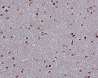 Immunohistochemistry (Formalin/PFA-fixed paraffin-embedded sections) - Anti-LSM5 antibody [EPR10690] - BSA and Azide free (AB250769), expandable thumbnail