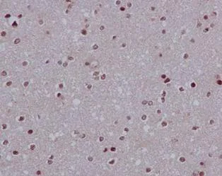Immunohistochemistry (Formalin/PFA-fixed paraffin-embedded sections) - Anti-LSM5 antibody [EPR10690] - BSA and Azide free (AB250769)
