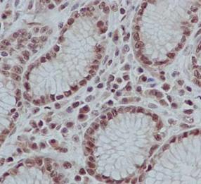 Immunohistochemistry (Formalin/PFA-fixed paraffin-embedded sections) - Anti-LSM5 antibody [EPR10690] - BSA and Azide free (AB250769), expandable thumbnail