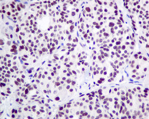 Immunohistochemistry (Formalin/PFA-fixed paraffin-embedded sections) - Anti-LSM5 antibody [EPR10691(B)] (AB151717), expandable thumbnail