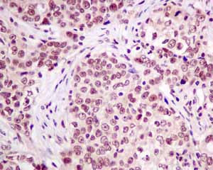 Immunohistochemistry (Formalin/PFA-fixed paraffin-embedded sections) - Anti-LSM5 antibody [EPR10691(B)] (ab151717), expandable thumbnail