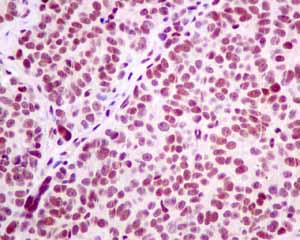 Immunohistochemistry (Formalin/PFA-fixed paraffin-embedded sections) - Anti-LSM5 antibody [EPR10691(B)] (AB151717), expandable thumbnail
