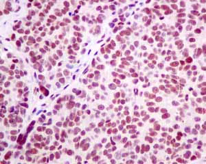 Immunohistochemistry (Formalin/PFA-fixed paraffin-embedded sections) - Anti-LSM5 antibody [EPR10691(B)] (AB151717)