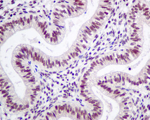 Immunohistochemistry (Formalin/PFA-fixed paraffin-embedded sections) - Anti-LSM5 antibody [EPR10691(B)] (AB151717), expandable thumbnail