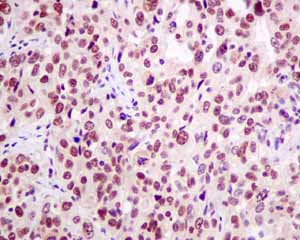 Immunohistochemistry (Formalin/PFA-fixed paraffin-embedded sections) - Anti-LSM5 antibody [EPR10691(B)] (AB151717), expandable thumbnail