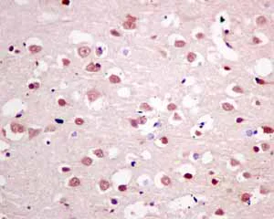 Immunohistochemistry (Formalin/PFA-fixed paraffin-embedded sections) - Anti-LSM5 antibody [EPR10691(B)] (AB151717)