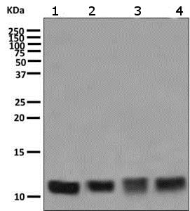 Western blot - Anti-LSM5 antibody [EPR10691(B)] (AB151717), expandable thumbnail