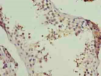 Immunohistochemistry (Formalin/PFA-fixed paraffin-embedded sections) - Anti-LSM7 antibody (AB235332), expandable thumbnail
