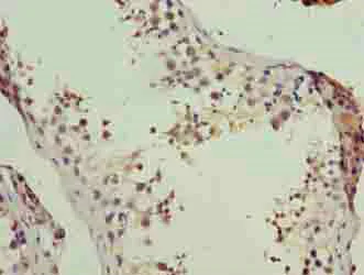 Immunohistochemistry (Formalin/PFA-fixed paraffin-embedded sections) - Anti-LSM7 antibody (AB235332)
