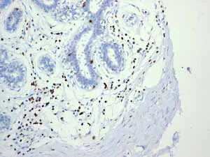 Immunohistochemistry (Formalin/PFA-fixed paraffin-embedded sections) - Anti-LSP1 antibody [EPR3160] (AB134099)