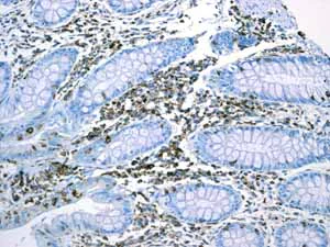 Immunohistochemistry (Formalin/PFA-fixed paraffin-embedded sections) - Anti-LSP1 antibody [EPR3160] (AB134099)