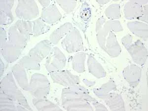 Immunohistochemistry (Formalin/PFA-fixed paraffin-embedded sections) - Anti-LSP1 antibody [EPR3160] (AB134099)