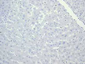 Immunohistochemistry (Formalin/PFA-fixed paraffin-embedded sections) - Anti-LSP1 antibody [EPR3160] (AB134099)