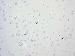 Immunohistochemistry (Formalin/PFA-fixed paraffin-embedded sections) - Anti-LSP1 antibody [EPR3160] (AB134099)