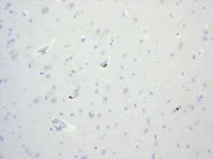 Immunohistochemistry (Formalin/PFA-fixed paraffin-embedded sections) - Anti-LSP1 antibody [EPR3160] (AB134099)